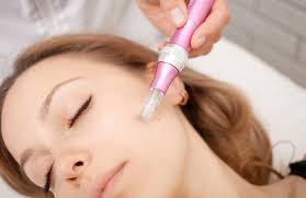 Thinking about trying microneedling?